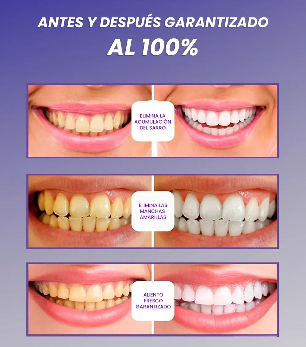 SMILEKIT - BLANQUEADOR DENTAL PREMIUM